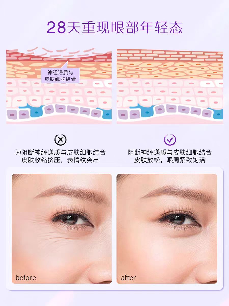 Freezeframe Revitaleyes FF 紧致眼霜15ml