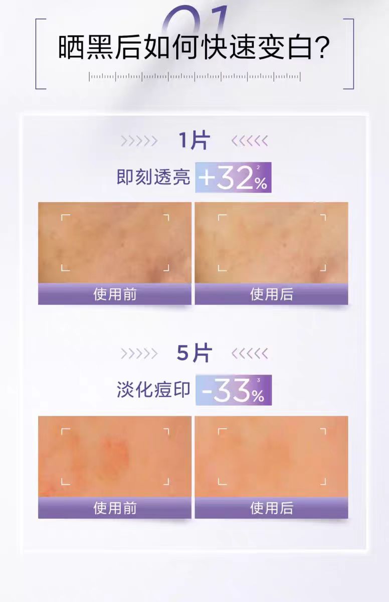 欧莱雅臻白晶透密集淡斑沁白精华面膜(国货面膜)