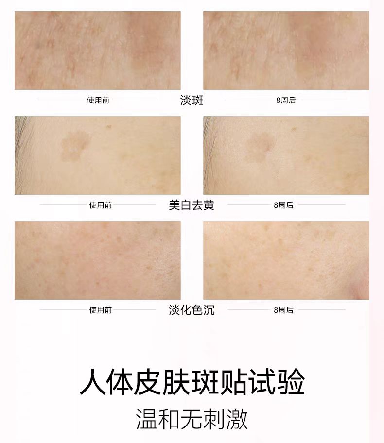FAN BEAUTY DIARY美白晶透粉润 芍药美白面膜 5片/盒(国货面膜)