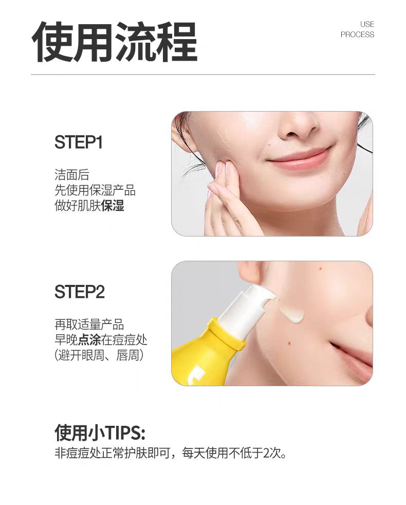 羽素大灯泡祛痘精华液快速瘪痘舒缓