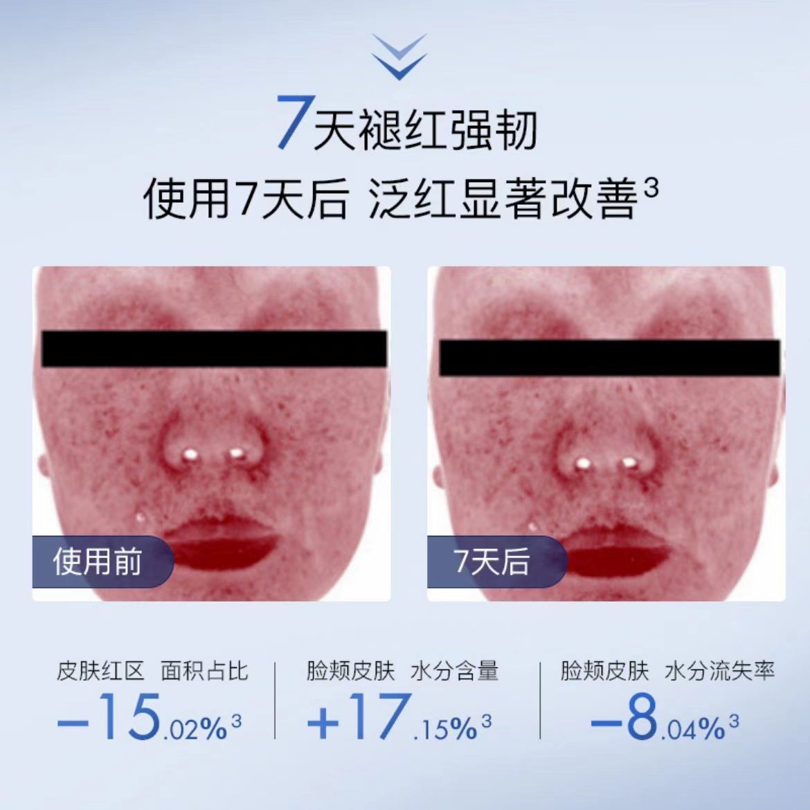 绽媄娅钝感力焕能修护安肌精华液