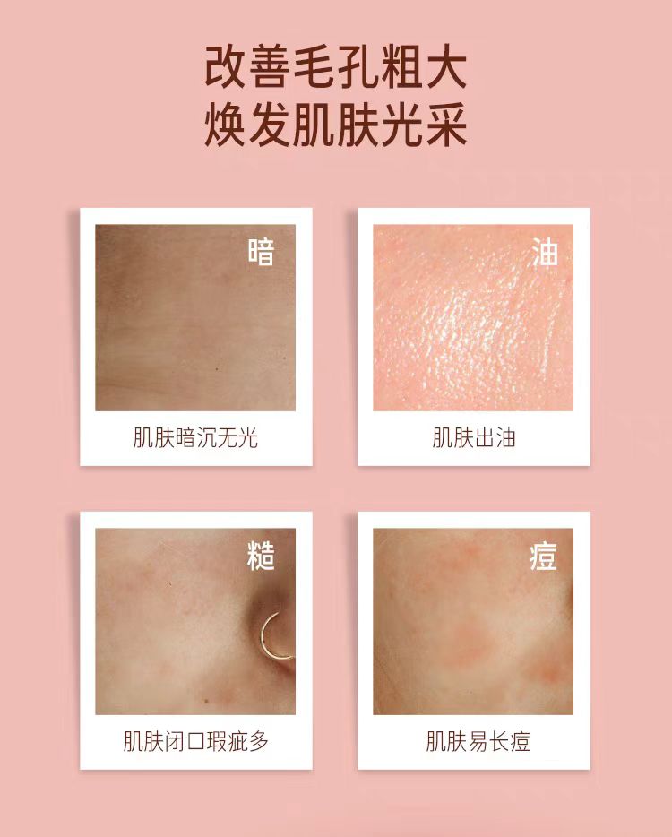 Pixi果酸发光焕肤爽肤水 补水保湿细腻毛孔