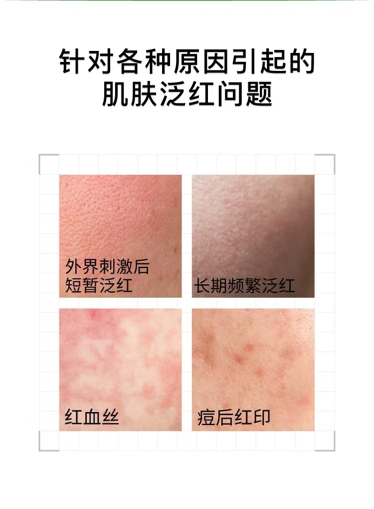 John Jeff积雪草精华液30ml 舒缓褪红