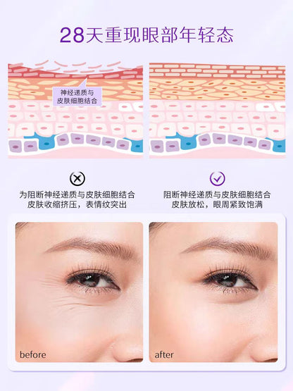 Freezeframe Revitaleyes FF 紧致眼霜15ml