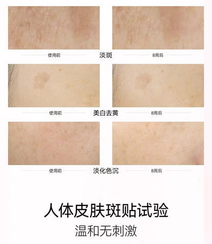 FAN BEAUTY DIARY美白晶透粉润 芍药美白面膜 5片/盒（国货面膜）