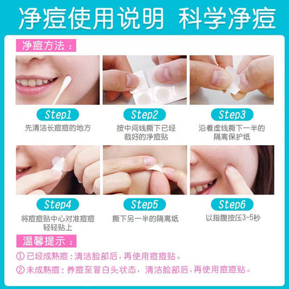 护妍天使痘痘贴隐形日夜综合