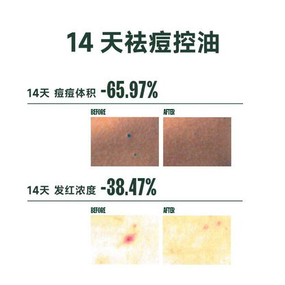 芙芙清透焕肤身体祛痘喷雾150ml