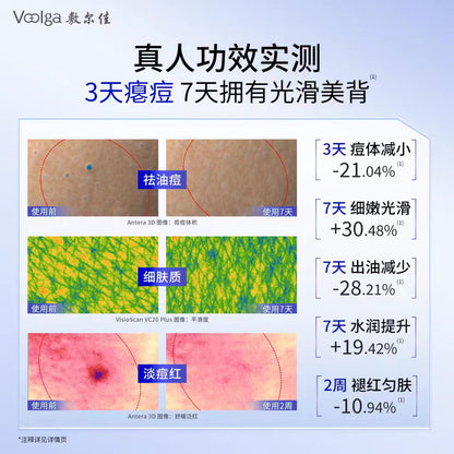 敷尔佳祛痘舒缓身体喷雾水杨酸美背前胸后背保湿120ml