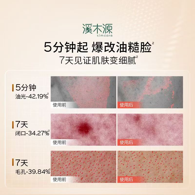 溪木源层孔菌智控水乳 去黑头平闭口油皮敏感肌
