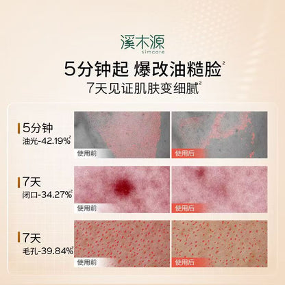溪木源层孔菌智控水乳 去黑头平闭口油皮敏感肌
