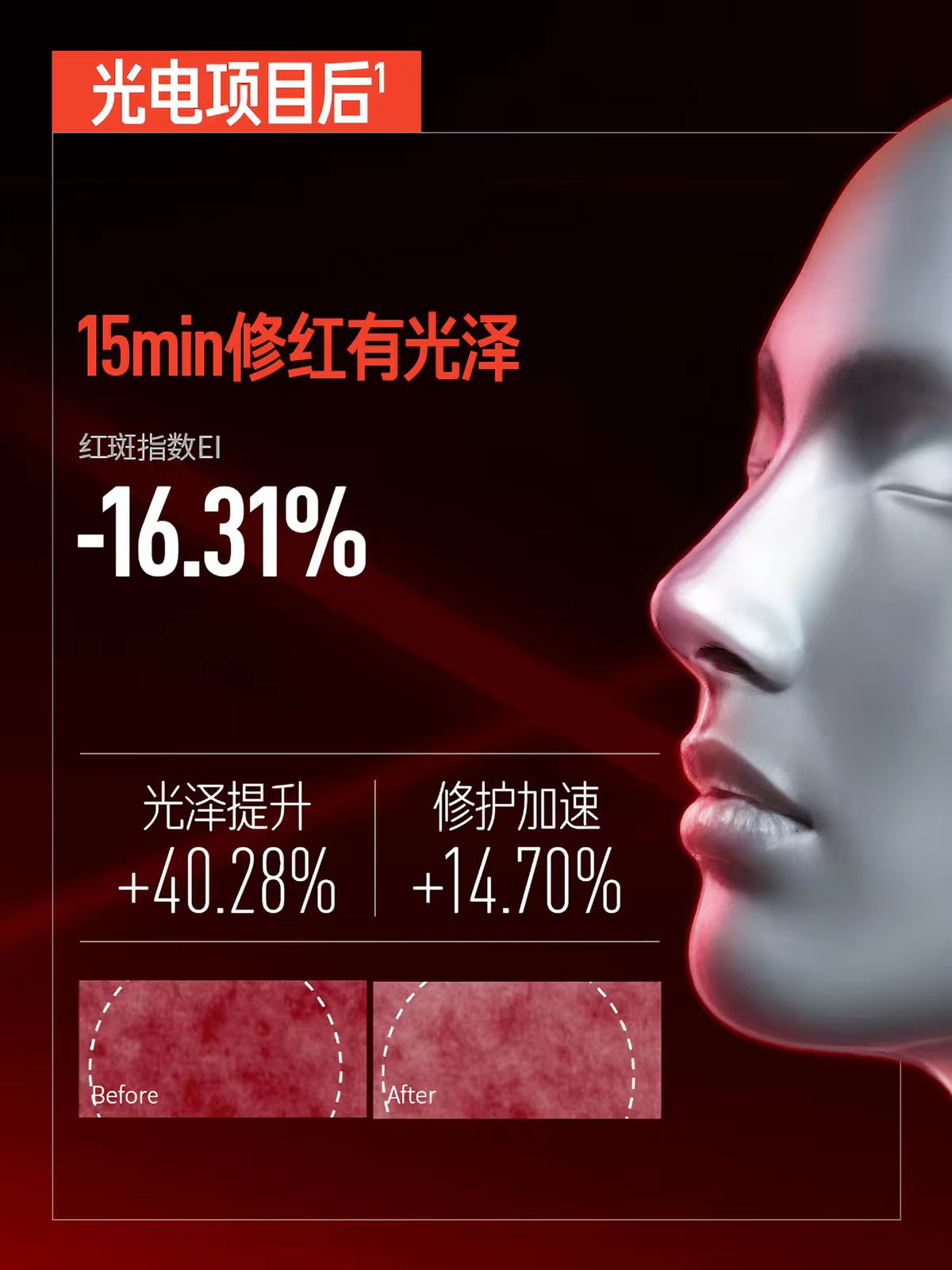 毕生之研厚脸皮B5面膜5片/盒 敏肌修护